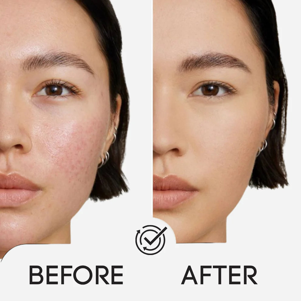 Elevare™ Anti-Aging Korean Toner Pads (100-Pads)